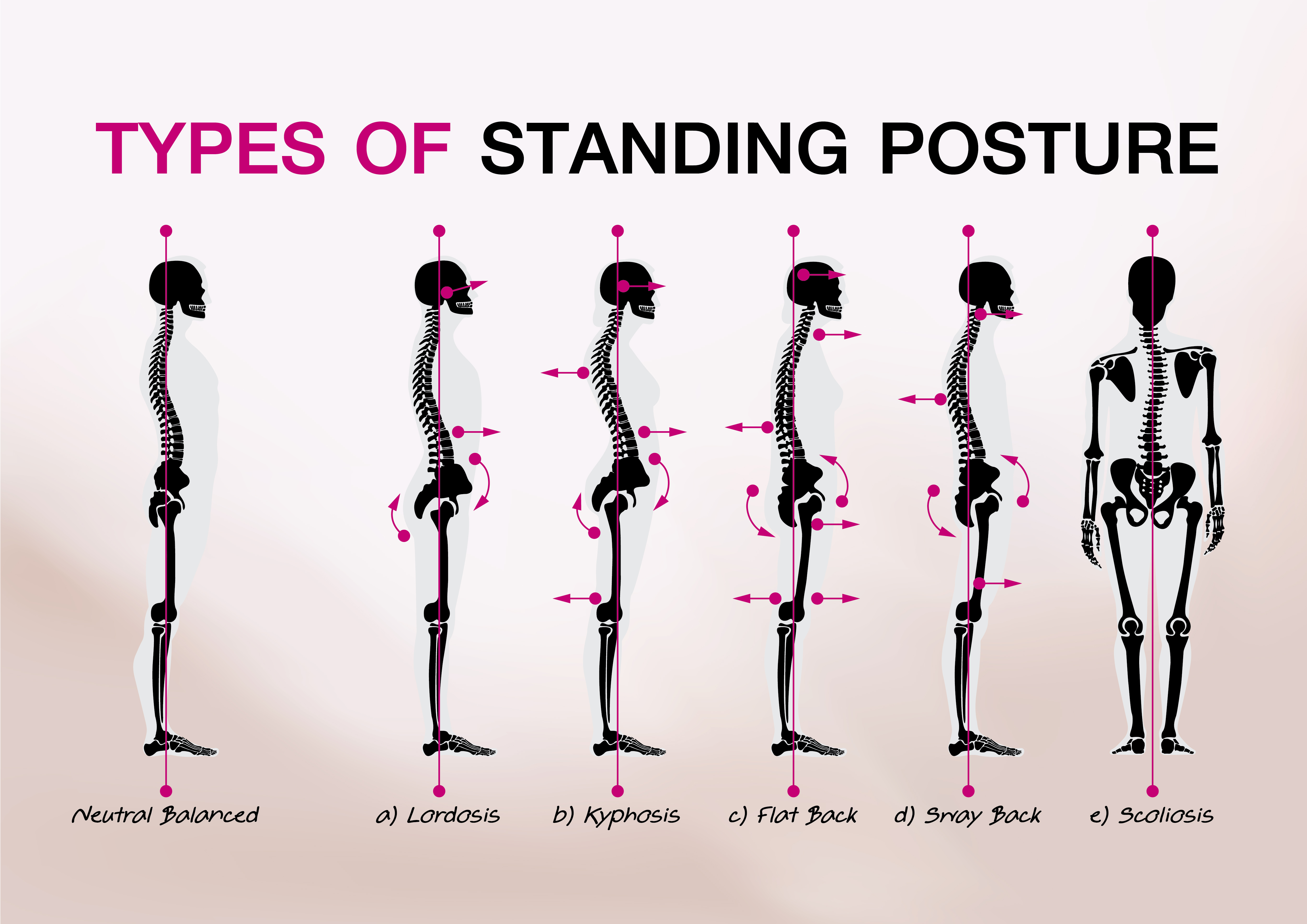 Is your posture hurting you? Body Fit Solutions